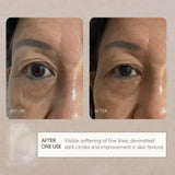 OptimaLift A+ Deep Recovery Eye Mask - ést.lab