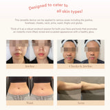 VitaLift A+ SmartSculpt Buddy