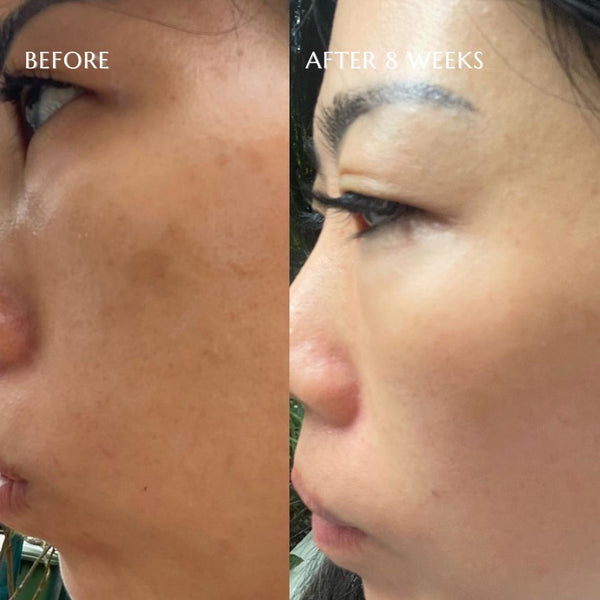 LumiGlow TXA Brightening Cream